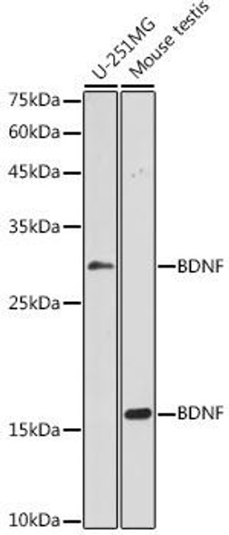 Cell Biology Antibodies 6 Anti-BDNF Antibody CAB16299