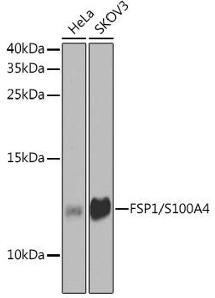KO Validated Antibodies 1 Anti-FSP1/S100A4 Antibody CAB1631KO Validated