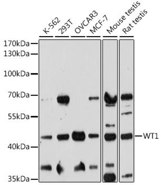 Epigenetics and Nuclear Signaling Antibodies 2 Anti-WT1 Antibody CAB16319