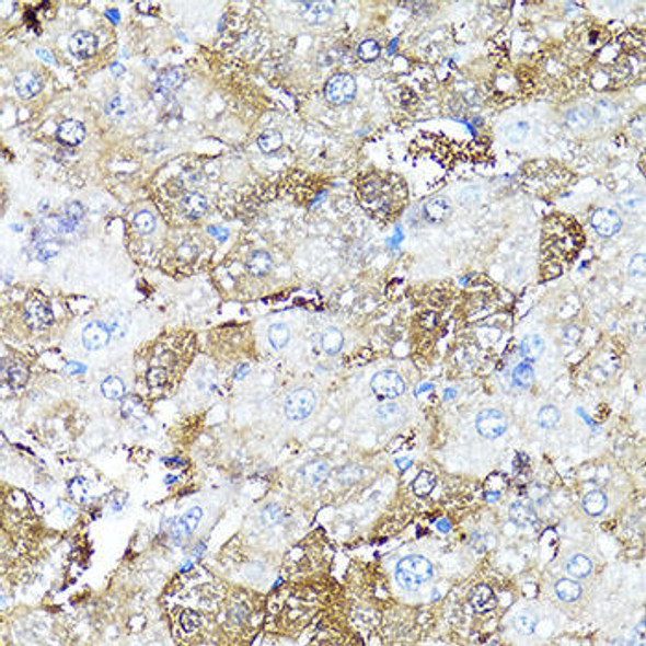 Cell Death Antibodies 1 Anti-COMP Antibody CAB16331