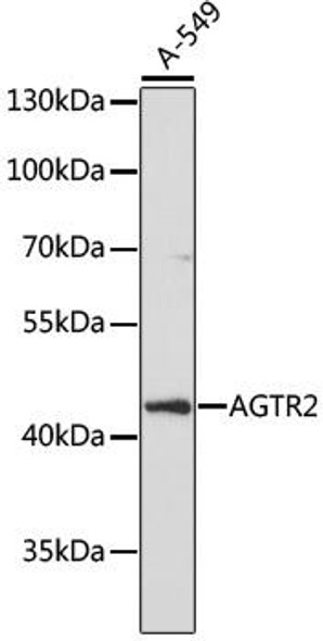 Cell Biology Antibodies 7 Anti-AGTR2 Antibody CAB16342