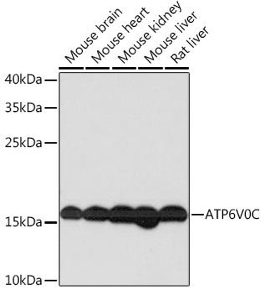 Immunology Antibodies 2 Anti-ATP6V0C Antibody CAB16350