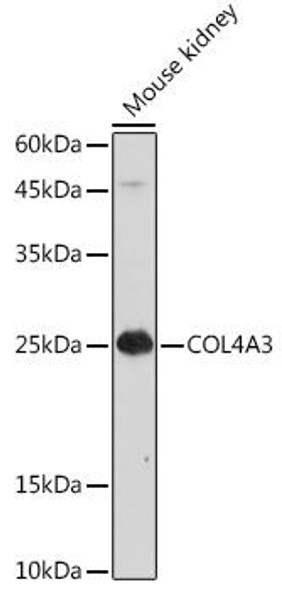 Cell Biology Antibodies 7 Anti-COL4A3 Antibody CAB16359