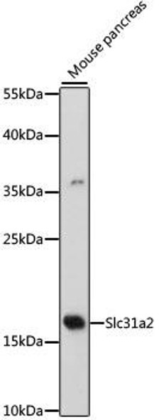 Cell Biology Antibodies 7 Anti-Slc31a2 Antibody CAB16362