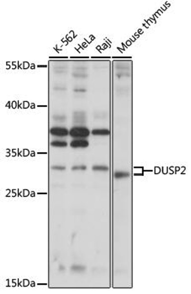 Cell Biology Antibodies 7 Anti-DUSP2 Antibody CAB16366