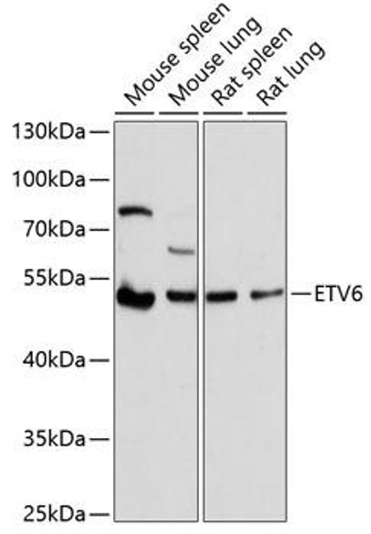 Epigenetics and Nuclear Signaling Antibodies 2 Anti-ETV6 Antibody CAB1637