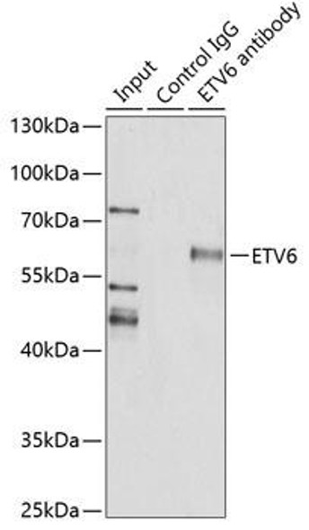 Epigenetics and Nuclear Signaling Antibodies 2 Anti-ETV6 Antibody CAB1637