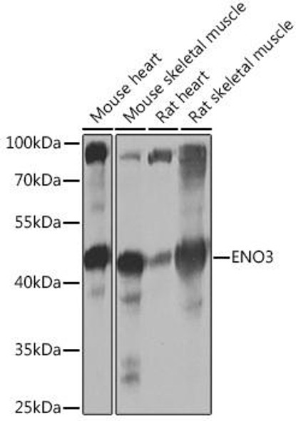 Metabolism Antibodies 2 Anti-ENO3 Antibody CAB16371