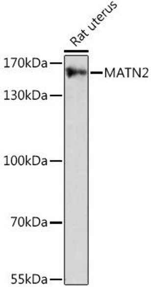 Cell Biology Antibodies 7 Anti-MATN2 Antibody CAB16397