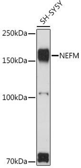 Cell Biology Antibodies 7 Anti-NEFM Antibody CAB16405