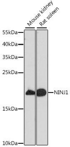 Cell Biology Antibodies 7 Anti-NINJ1 Antibody CAB16406