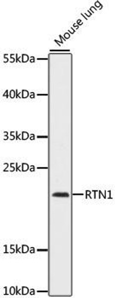 Cell Biology Antibodies 7 Anti-RTN1 Antibody CAB16427
