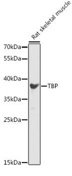 Immunology Antibodies 2 Anti-TBP Antibody CAB16436