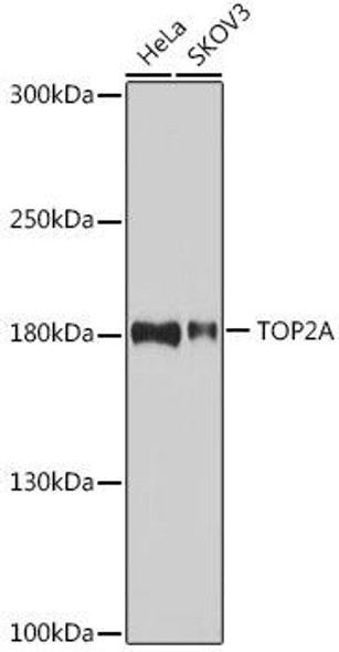 Cell Biology Antibodies 7 Anti-TOP2A Antibody CAB16440