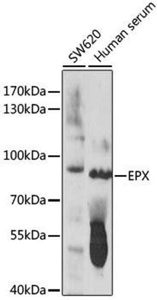 Signal Transduction Antibodies 2 Anti-EPX Antibody CAB16450