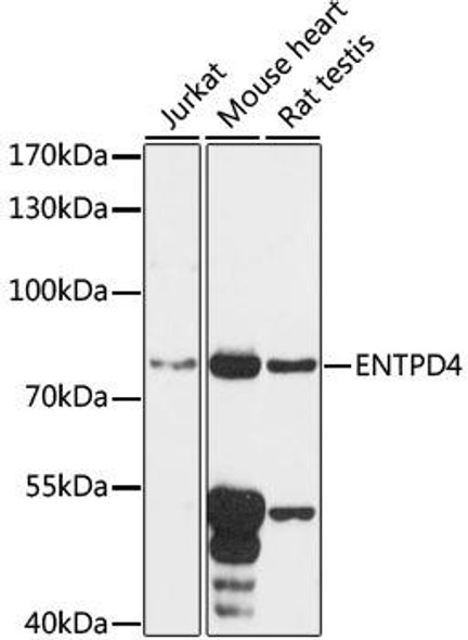 Cell Biology Antibodies 7 Anti-ENTPD4 Antibody CAB16469