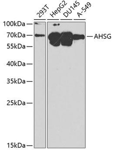 Signal Transduction Antibodies 2 Anti-AHSG Antibody CAB1647