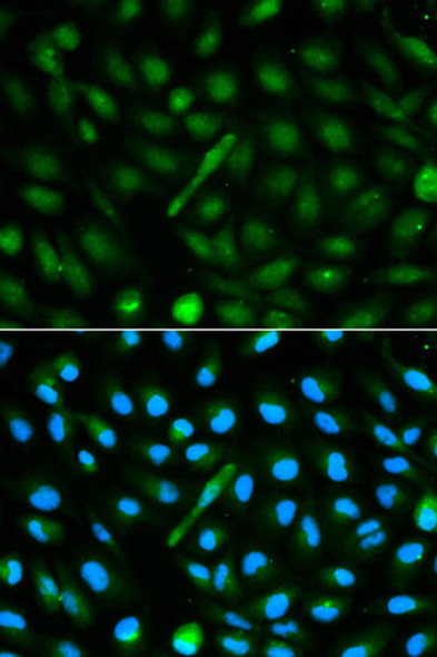 Signal Transduction Antibodies 2 Anti-AHSG Antibody CAB1647