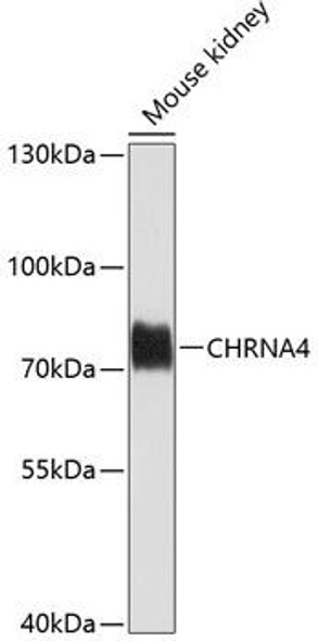 Signal Transduction Antibodies 2 Anti-CHRNA4 Antibody CAB1648