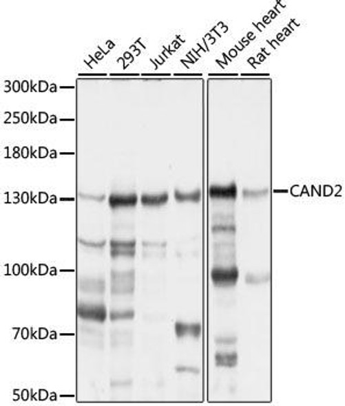 Epigenetics and Nuclear Signaling Antibodies 2 Anti-CAND2 Antibody CAB16500