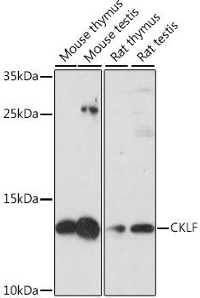 Cell Biology Antibodies 7 Anti-CKLF Antibody CAB16528