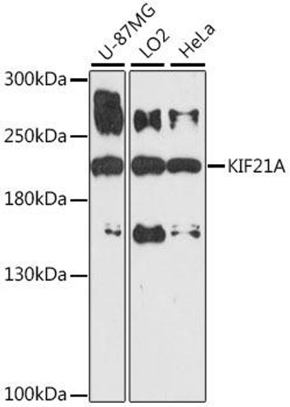 Cell Biology Antibodies 7 Anti-KIF21A Antibody CAB16548