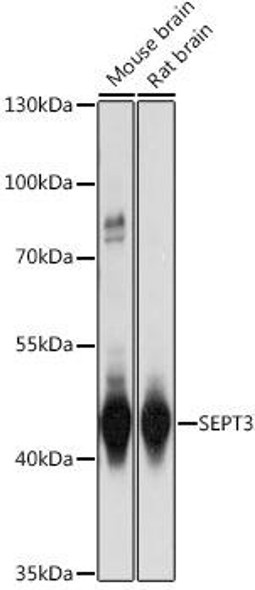 Cell Cycle Antibodies 1 Anti-SEPT3 Antibody CAB16551