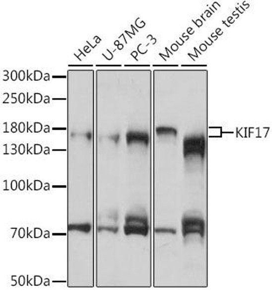 Cell Biology Antibodies 7 Anti-KIF17 Antibody CAB16562