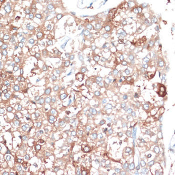 Immunology Antibodies 2 Anti-SLAMF7 Antibody CAB16565