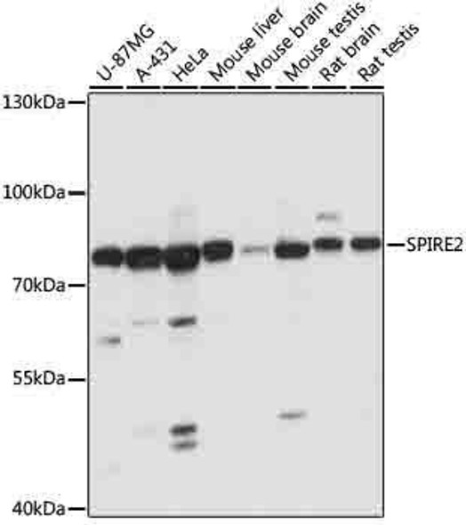 Cell Biology Antibodies 7 Anti-SPIRE2 Antibody CAB16582