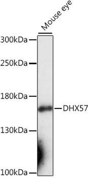 Cell Biology Antibodies 7 Anti-DHX57 Antibody CAB16588