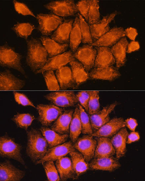 Cell Biology Antibodies 7 Anti-CFAP53 Antibody CAB16607