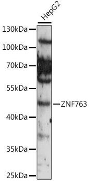 Epigenetics and Nuclear Signaling Antibodies 3 Anti-ZNF763 Antibody CAB16615