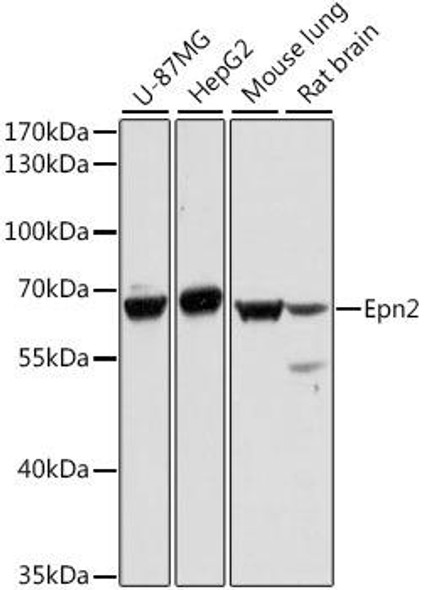 Cell Biology Antibodies 7 Anti-Epn2 Antibody CAB16623