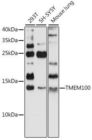 Signal Transduction Antibodies 2 Anti-TMEM100 Antibody CAB16653