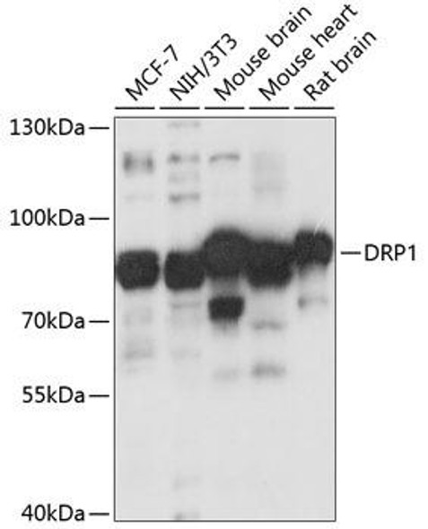 Cell Biology Antibodies 7 Anti-DRP1 Antibody CAB16661