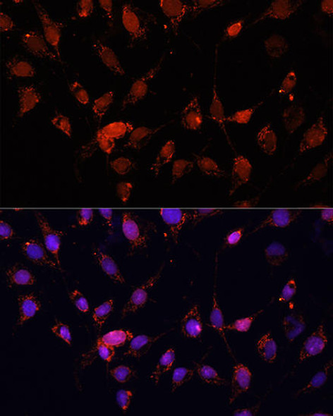 Signal Transduction Antibodies 2 Anti-EIF4EBP1 Antibody CAB16667