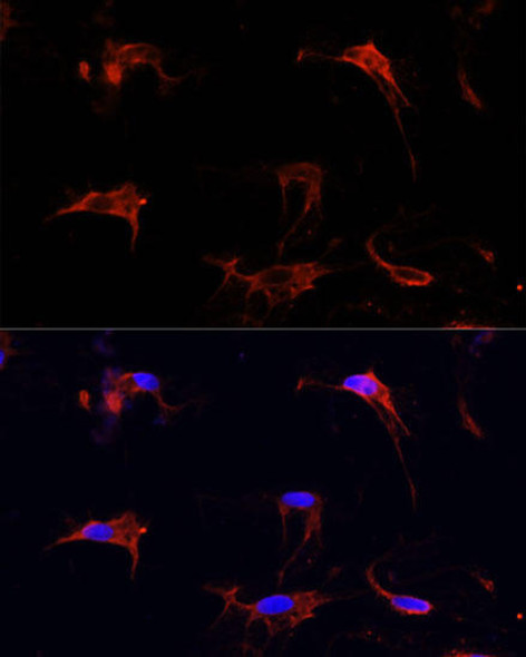 Cell Biology Antibodies 7 Anti-FBN1 Antibody CAB16677