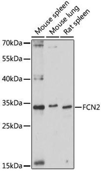 Immunology Antibodies 2 Anti-FCN2 Antibody CAB16690
