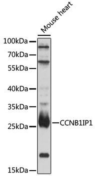 Cell Biology Antibodies 7 Anti-CCNB1IP1 Antibody CAB16693