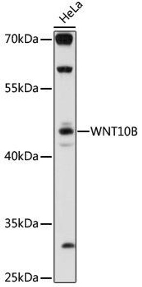 Metabolism Antibodies 2 Anti-WNT10B Antibody CAB16717