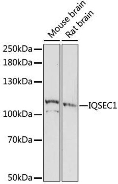 Cell Biology Antibodies 7 Anti-IQSEC1 Antibody CAB16725