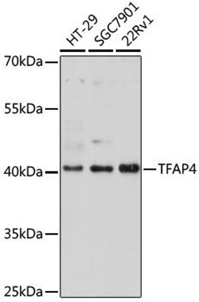 KO Validated Antibodies 1 Anti-TFAP4 Antibody CAB16727KO Validated