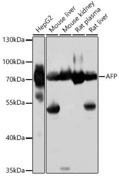 Cell Biology Antibodies 7 Anti-AFP Antibody CAB16750