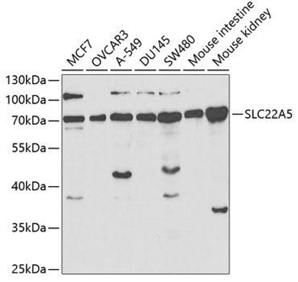 Signal Transduction Antibodies 2 Anti-SLC22A5 Antibody CAB1676