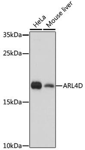 Signal Transduction Antibodies 2 Anti-ARL4D Antibody CAB16761