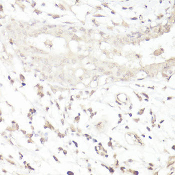 Signal Transduction Antibodies 2 Anti-DMP1 Antibody CAB16832