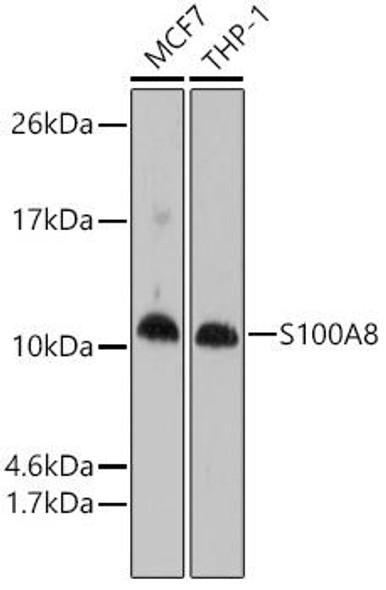 Cell Death Antibodies 1 Anti-S100A8 Antibody CAB1688