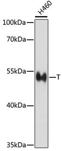 Epigenetics and Nuclear Signaling Antibodies 3 Anti-T Antibody CAB16887