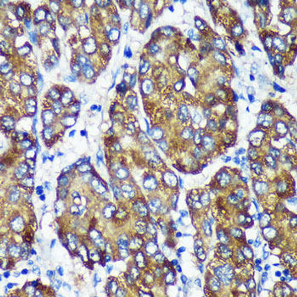 KO Validated Antibodies 1 Anti-NSDHL Antibody CAB16893KO Validated